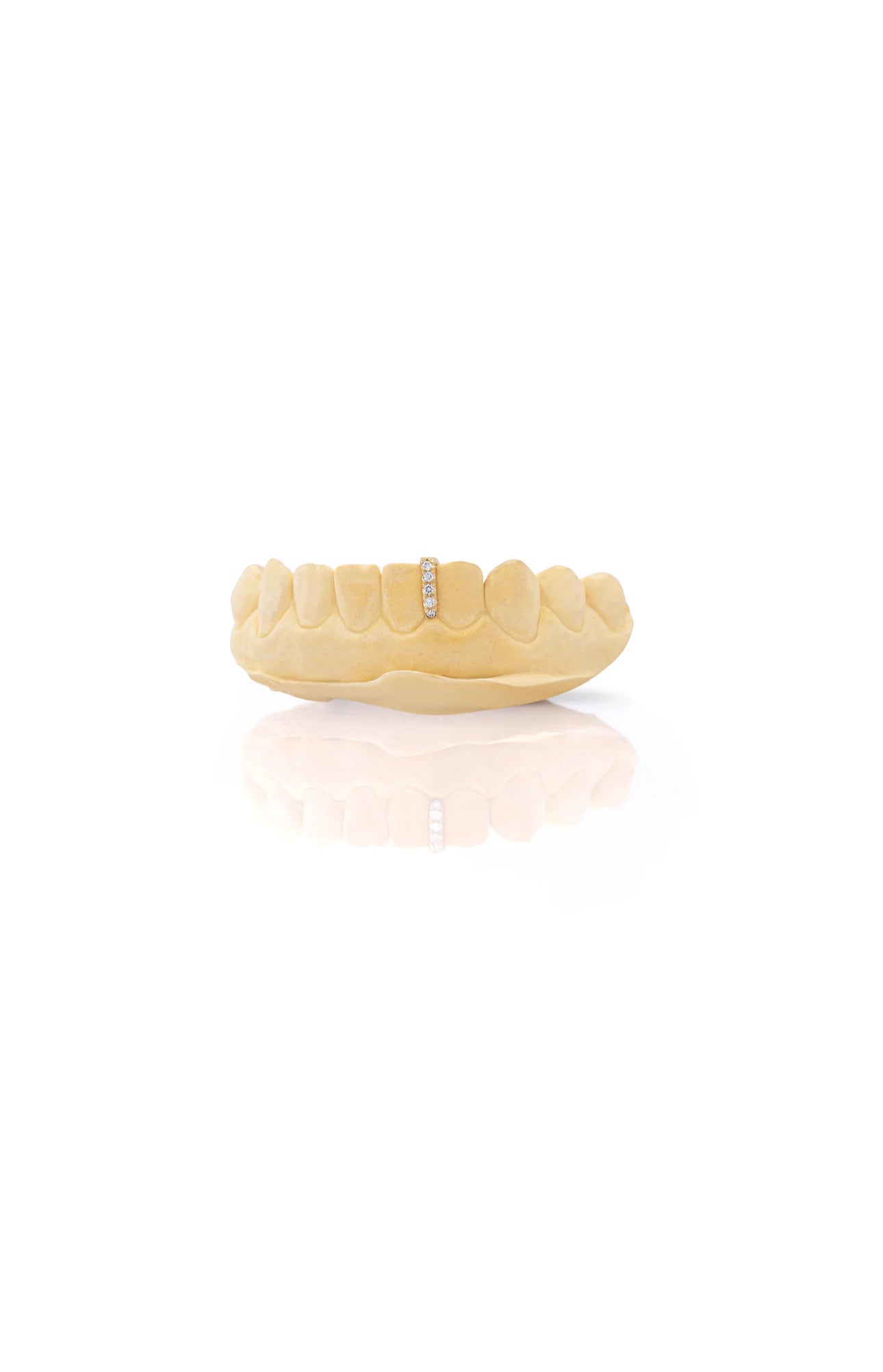 Diamond Gap Caps